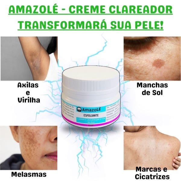 Creme Clareador de Manchas na Pele AMAZOLÉ - 200g